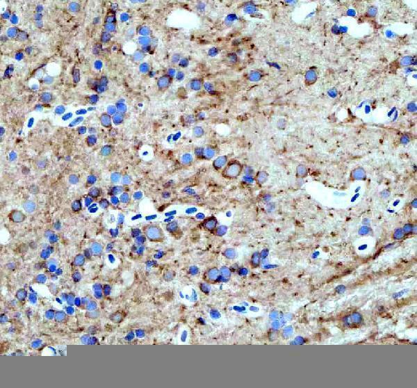 azq7szd3 hspa5 primary antibodies ihc testing 5