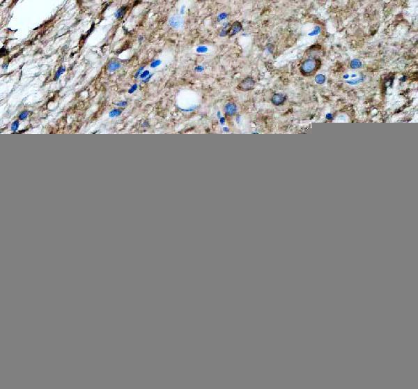 azq7szd3 hspa5 primary antibodies ihc testing 6
