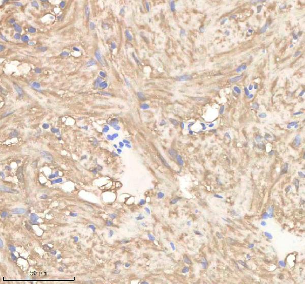 azq7szr4 pgam1a b primary antibodies ihc testing 1