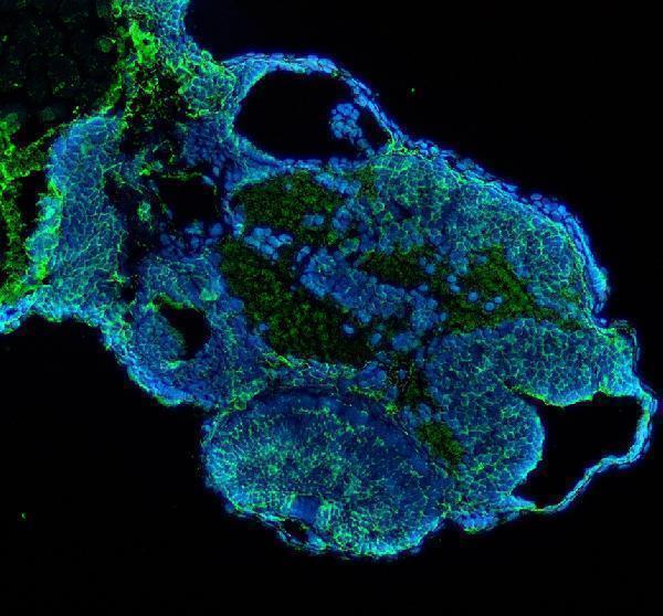 IF analysis of DUSP6 using anti-DUSP6 antibody (AZQ7T2L8)