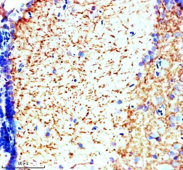 IHC analysis of DUSP6 using anti-DUSP6 antibody (AZQ7T2L8)