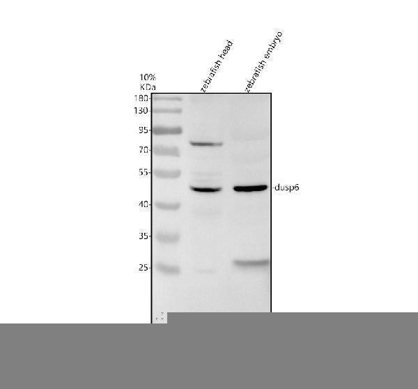 Western blot analysis of DUSP6 using anti-DUSP6 antibody (AZQ7T2L8)