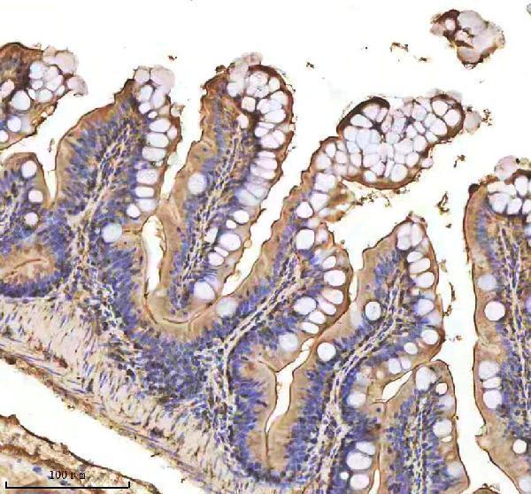  IHC analysis of MMP9 using anti-MMP9 antibody (AZQ7T317)