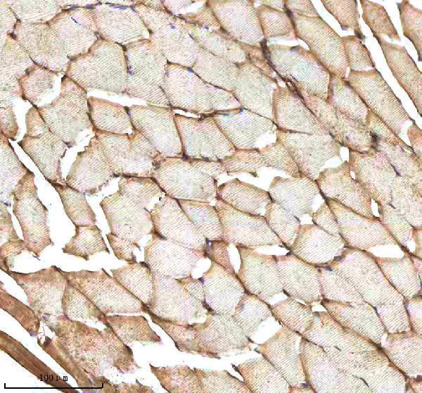  IHC analysis of MMP9 using anti-MMP9 antibody (AZQ7T317)