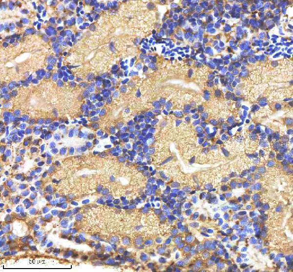  IHC analysis of MMP9 using anti-MMP9 antibody (AZQ7T317)