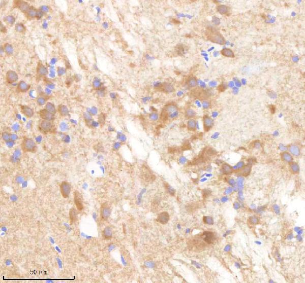 azq7t394 pafah1b1a b primary antibodies ihc testing 1