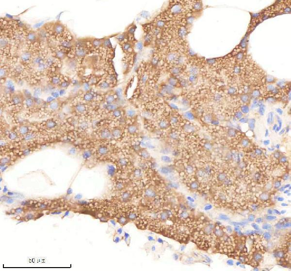azq7t394 pafah1b1a b primary antibodies ihc testing 5