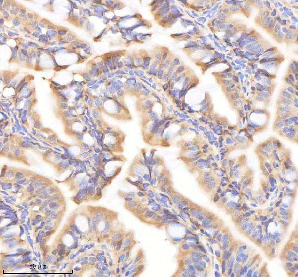 IHC analysis of PSMC2 using anti-PSMC2 antibody (AZQ7T3B1)