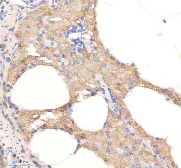 IHC analysis of PSMC2 using anti-PSMC2 antibody (AZQ7T3B1)