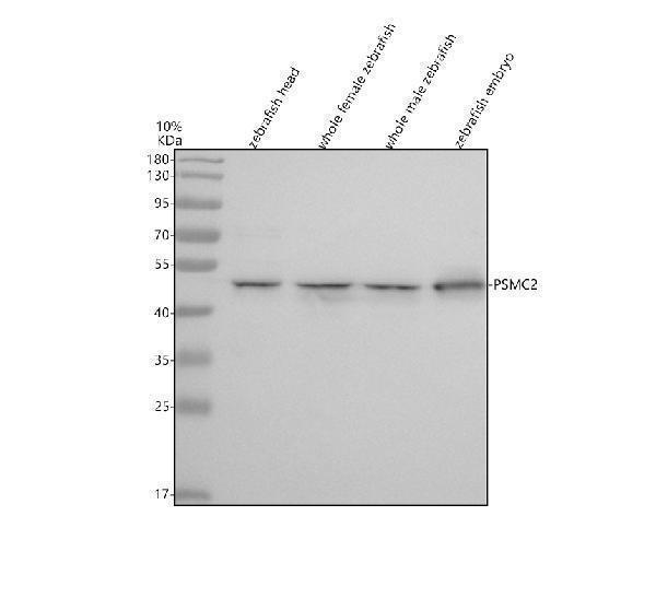 Western blot analysis of PSMC2 using anti-PSMC2 antibody (AZQ7T3B1)