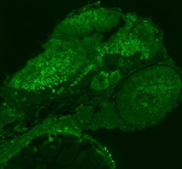 azq7zsy3 smarca4a primary antibodies if testing 1