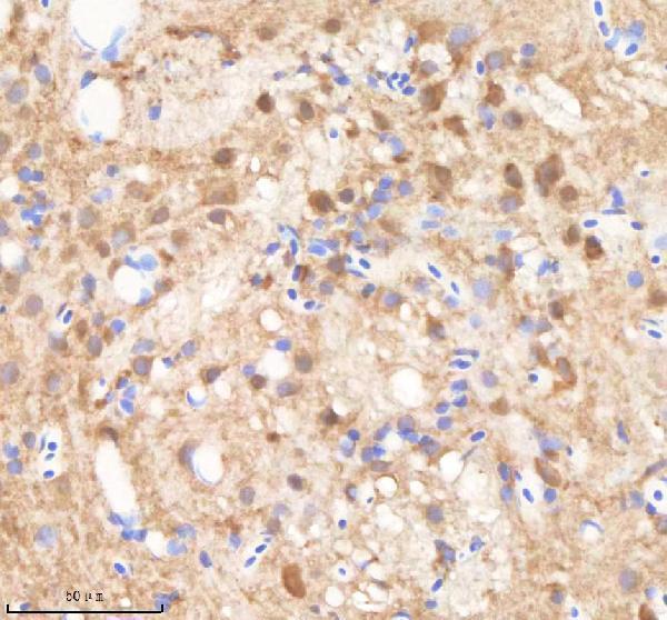 azq7zsy3 smarca4a primary antibodies ihc testing 1