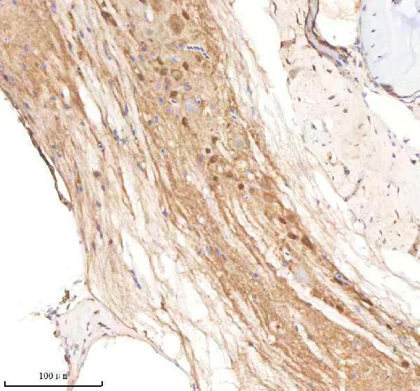 azq7zsy3 smarca4a primary antibodies ihc testing 2