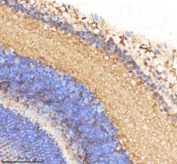azq7zsy3 smarca4a primary antibodies ihc testing 3