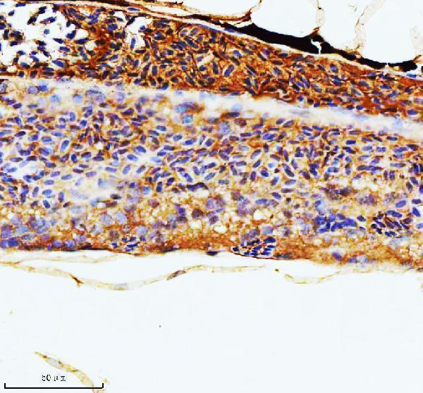  IHC analysis of RAC1 using anti-RAC1 antibody (AZQ7ZSZ9)