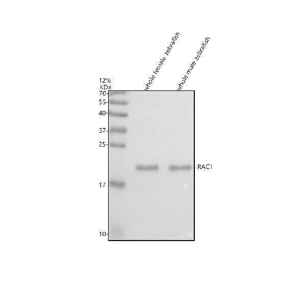  Western blot analysis of RAC1 using anti-RAC1 antibody (AZQ7ZSZ9)