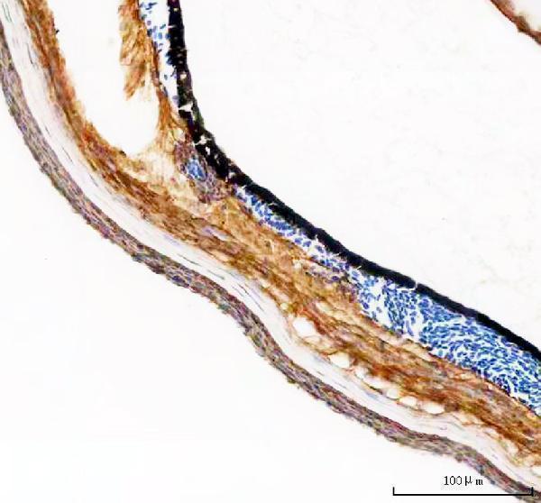 IHC analysis of KRT18 using anti-KRT18 antibody (AZQ7ZTS4)