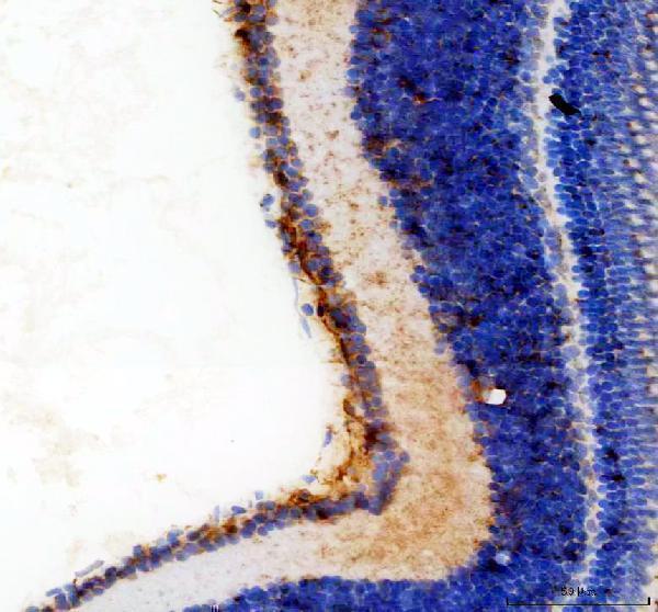 IHC analysis of KRT18 using anti-KRT18 antibody (AZQ7ZTS4)