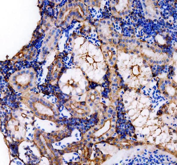 azq7zts4 krt18 primary antibodies ihc testing 3