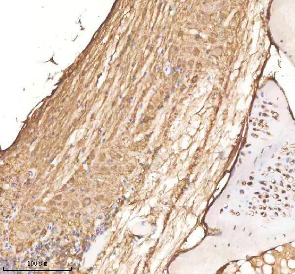 IHC analysis of VCP using anti-VCP antibody (AZQ7ZU99)