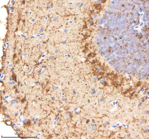 IHC analysis of VCP using anti-VCP antibody (AZQ7ZU99)
