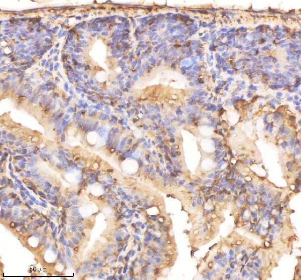 azq7zu99 vcp primary antibodies ihc testing 3
