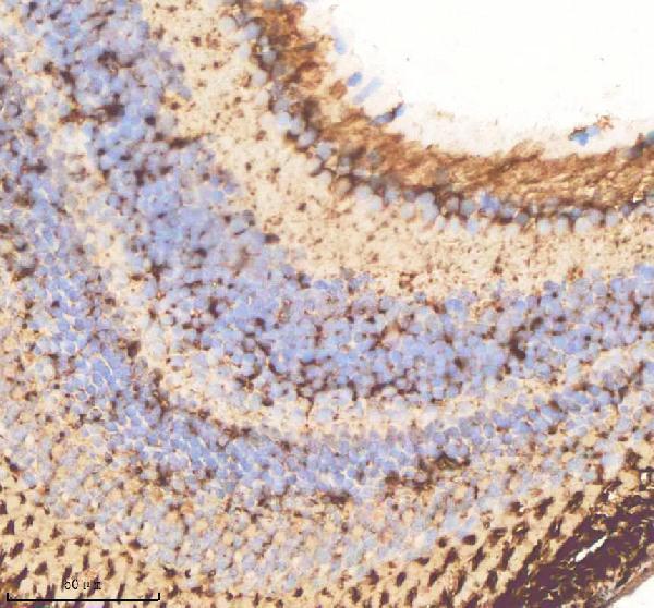 azq7zu99 vcp primary antibodies ihc testing 5