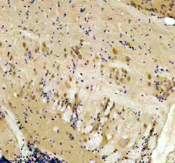azq7zup5 dnaja2a b primary antibodies ihc testing 2