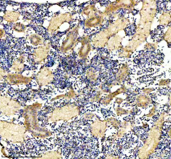 azq7zup5 dnaja2a b primary antibodies ihc testing 3