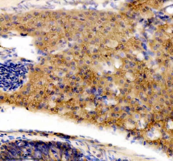 azq7zup5 dnaja2a b primary antibodies ihc testing 4