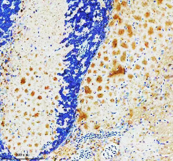  IHC analysis of PGK1 using anti-PGK1 antibody (AZQ7ZV29)