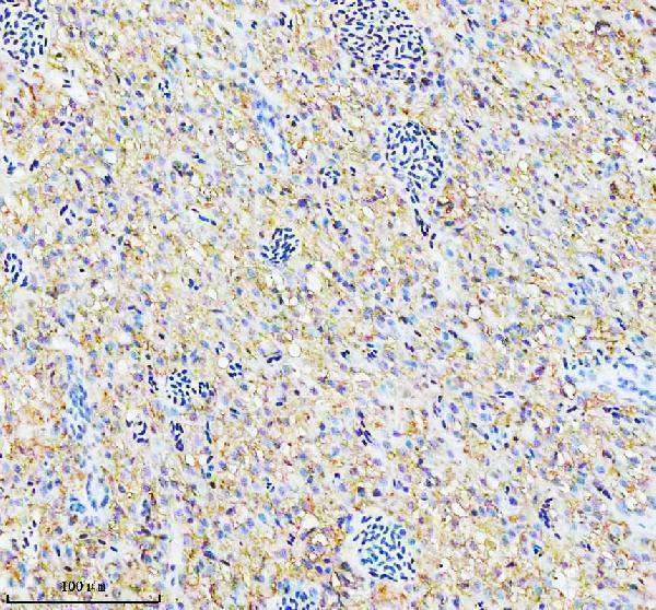  IHC analysis of PGK1 using anti-PGK1 antibody (AZQ7ZV29)