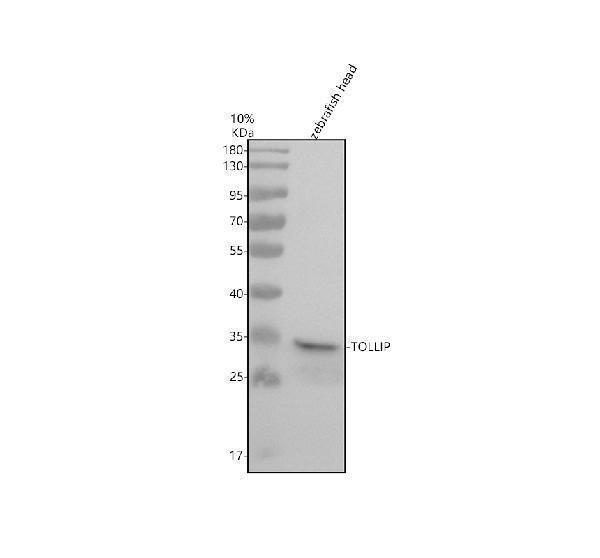 Western blot analysis of TOLLIP using anti-TOLLIP antibody (AZQ7ZV43)