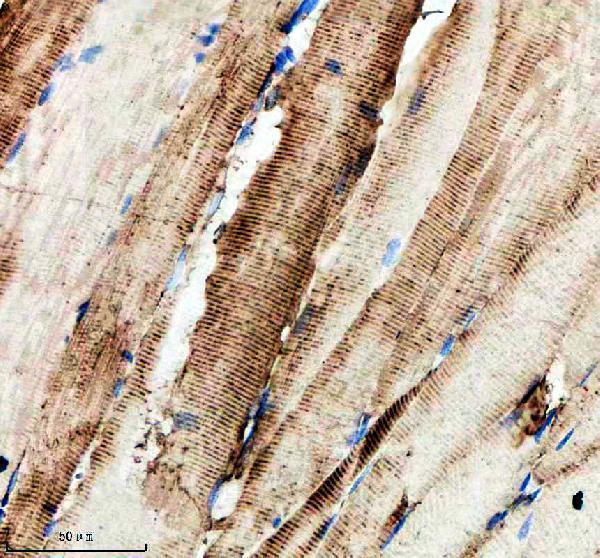  IHC analysis of HPRT1 using anti-HPRT1 antibody (AZQ7ZV49-1)