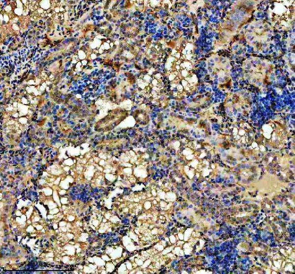 azq7zv49 1 hprt1 primary antibodies ihc testing 4