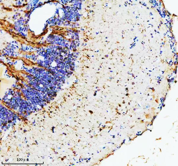  IHC analysis of HPRT1 using anti-HPRT1 antibody (AZQ7ZV49)