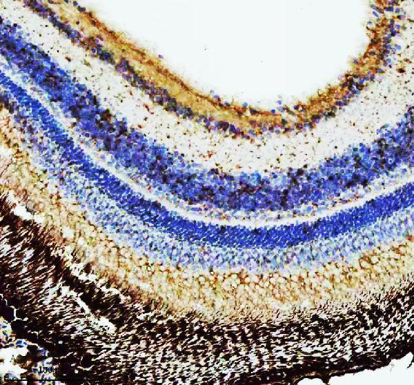  IHC analysis of HPRT1 using anti-HPRT1 antibody (AZQ7ZV49)