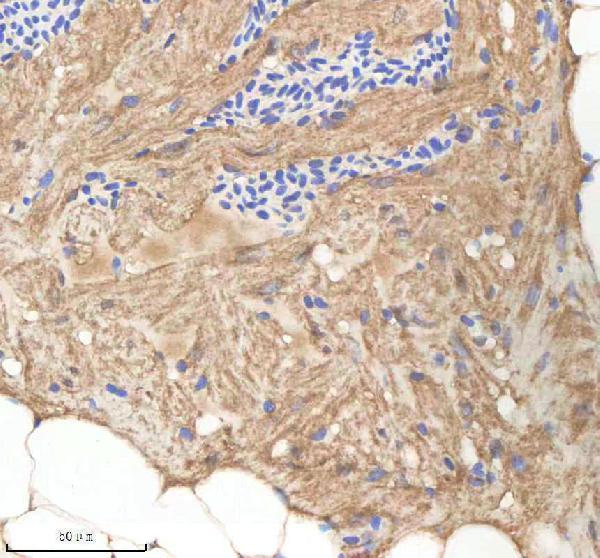 azq7zvi8 nploc4 primary antibodies ihc testing 1