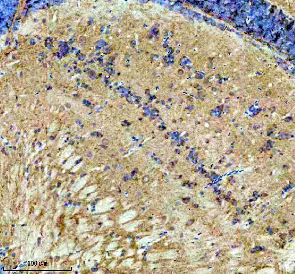  IHC analysis of DLST using anti-DLST antibody (AZQ7ZVL3)
