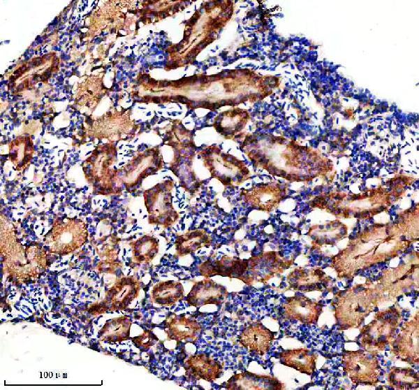  IHC analysis of DLST using anti-DLST antibody (AZQ7ZVL3)