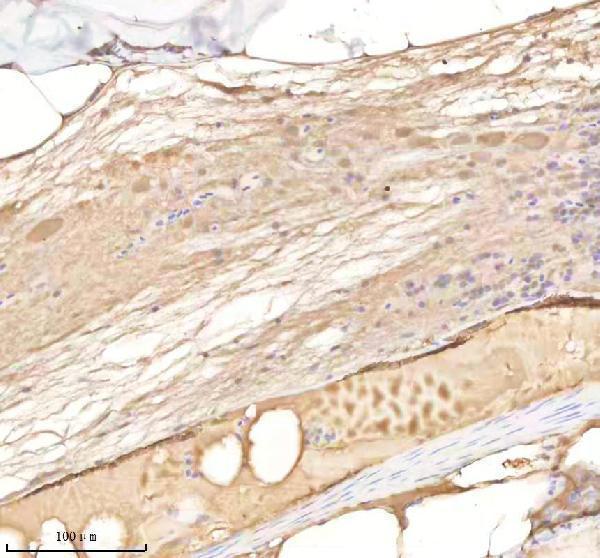 azq7zvx4 rab14 primary antibodies ihc testing 1