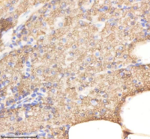 azq7zvx4 rab14 primary antibodies ihc testing 2
