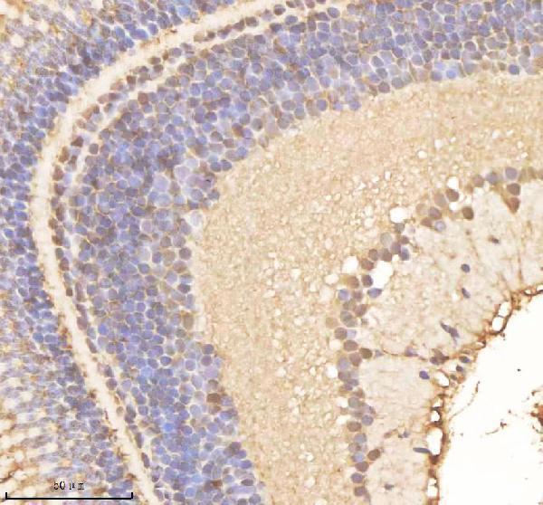 azq7zwd1 psmc1a b primary antibodies ihc testing 1