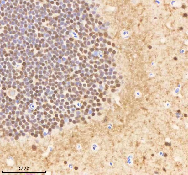 azq7zwd1 psmc1a b primary antibodies ihc testing 2