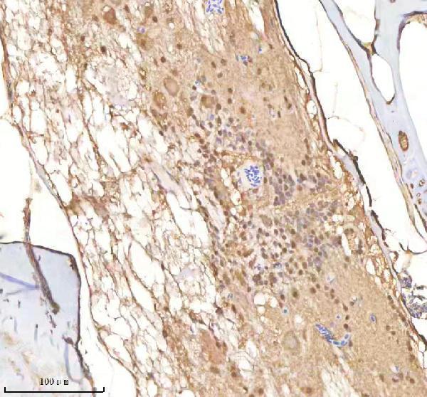 azq7zwd1 psmc1a b primary antibodies ihc testing 3