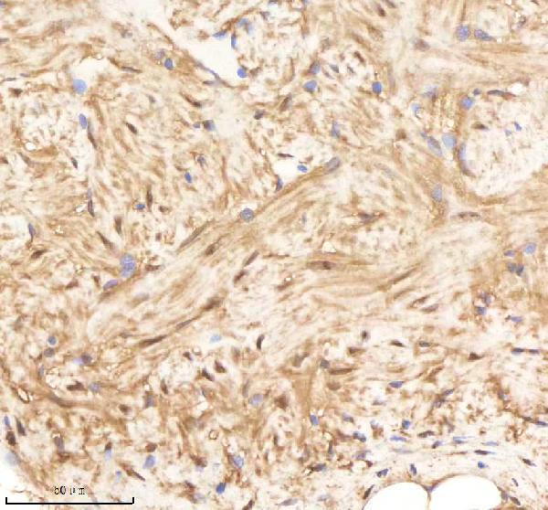 azq7zwd1 psmc1a b primary antibodies ihc testing 6