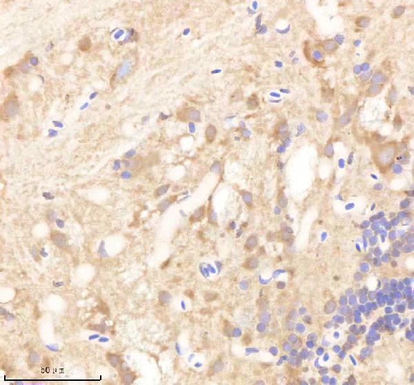 IHC analysis of PSMD6 using anti-PSMD6 antibody (AZQ7ZWE5)