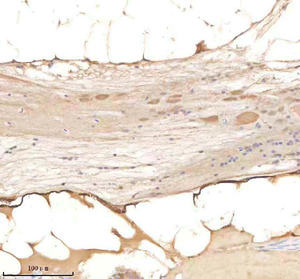 IHC analysis of PSMD6 using anti-PSMD6 antibody (AZQ7ZWE5)