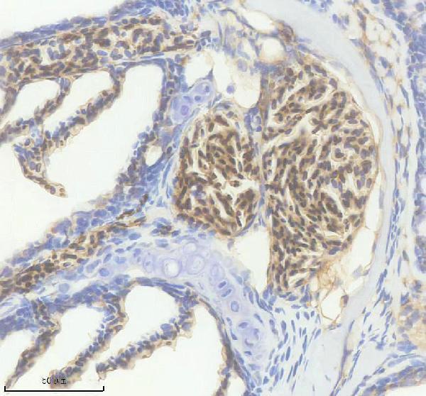 azq7zyz4 hbae3 primary antibodies ihc testing 1