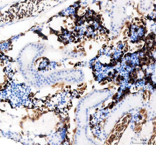 azq7zzj7 slc4a1a primary antibodies ihc testing 1